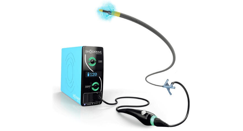 Johnson & Johnson MedTech Data Backs Shockwave Javelin Peripheral IVL Catheter